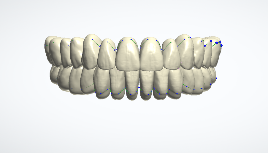 Denti naturali donna