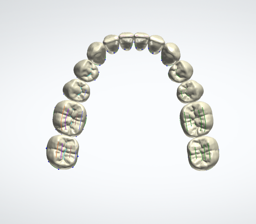 Denti naturali donna, vista occlusale inferiore