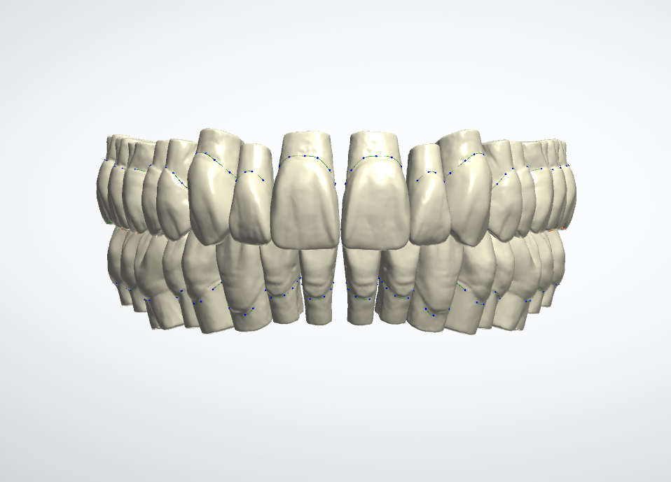 Denti naturali uomo