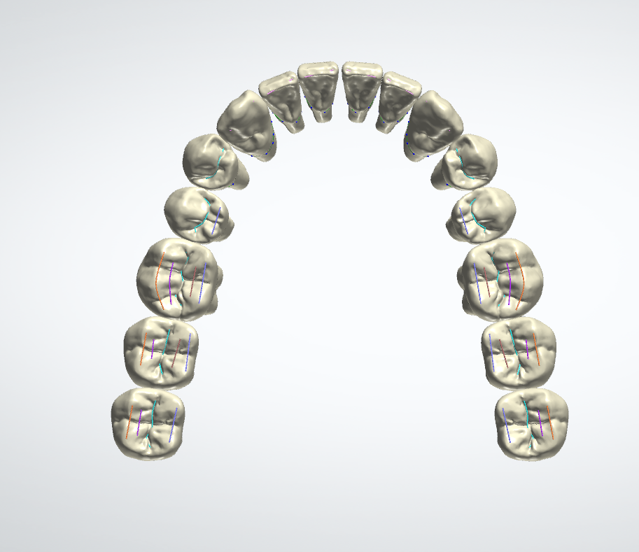 Denti naturali uomo, vista occlusale inferiore