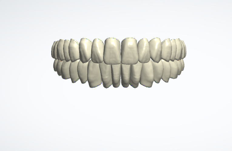 Denti per protesi
