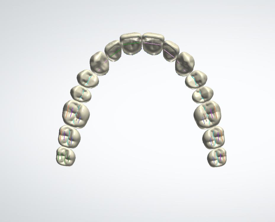 Denti per protesi, vista occlusale