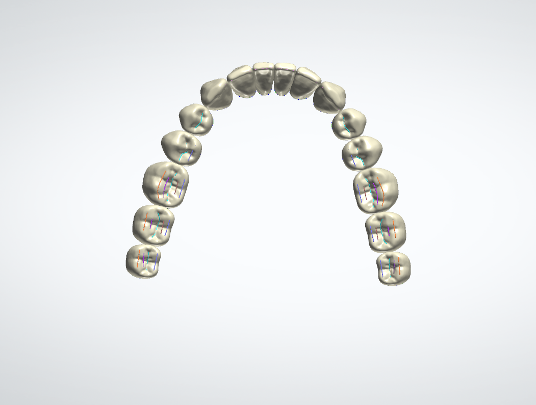 Denti per protesi, vista occlusale inferiore